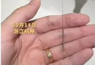 女私密针灸视频教程,女性健康养护秘籍视频教程解析
