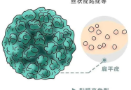 私密长有是hpv嘛,私密长疣与HPV病毒的关系揭秘